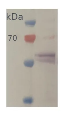 Anti-UGPase | UDP-glucose pyrophosphorylase (cytoplasm marker, dicots) - image 1